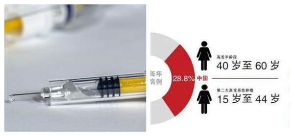 194个国家共同承诺消除宫颈癌 2030年HPV疫苗接种覆盖率达90%